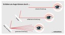 Laser: Schädigungsmöglichkeiten Auge